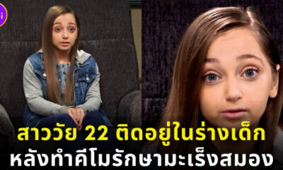 สาววัย 22 ติดอยู่ในร่างเด็ก 8 ขวบหลังทำคีโมรักษาโรคมะเร็งสมอง