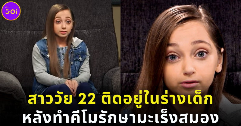 สาววัย 22 ติดอยู่ในร่างเด็ก 8 ขวบหลังทำคีโมรักษาโรคมะเร็งสมอง