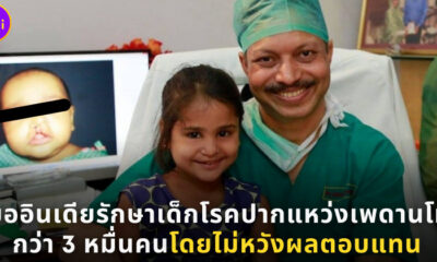 หมออินเดียใจบุญรักษาเด็กโรคปากแหว่งเพดานโหว่โดยไม่หวังผลตอบแทน