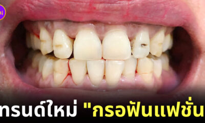 กรอฟันแฟชั่น