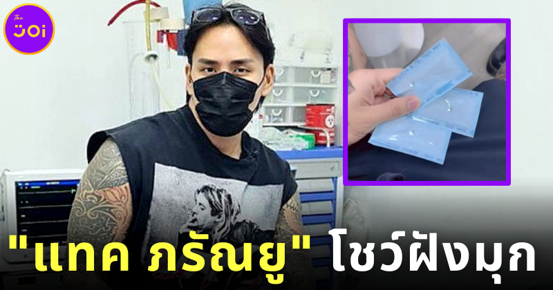 แทค ภรัณยู โพสต์โชว์ฝังมุก 3 เม็ด ชาวเน็ตแห่ขอดูผลงานหลังขึ้นเขียง