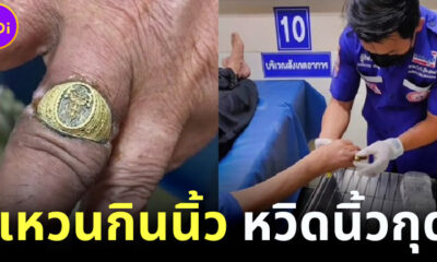 ชาวเน็ตแห่แชร์คลิป TikTok กู้ภัยโร่ช่วยชาย นิ้วกินแหวน หวิดนิ้วกุด!