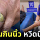 ชาวเน็ตแห่แชร์คลิป TikTok กู้ภัยโร่ช่วยชาย นิ้วกินแหวน หวิดนิ้วกุด!