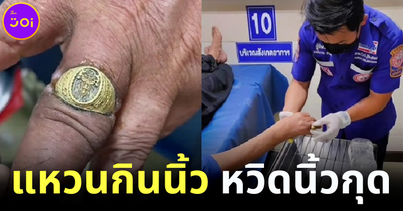 ชาวเน็ตแห่แชร์คลิป TikTok กู้ภัยโร่ช่วยชาย นิ้วกินแหวน หวิดนิ้วกุด!