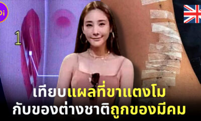 โป๊ะแตก! ชาวโซเชียลแฉภาพ แผลที่ขาแตงโม ถูกนำไปเทียบกับสาวอังกฤษถูกของมีคม
