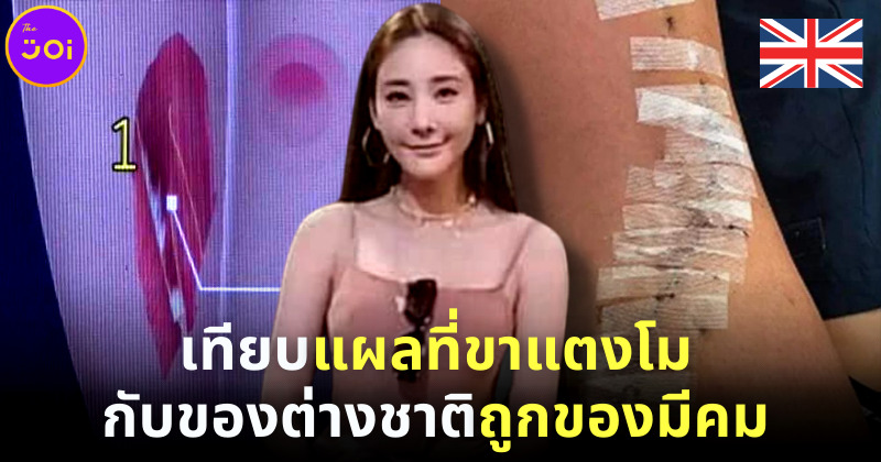 โป๊ะแตก! ชาวโซเชียลแฉภาพ แผลที่ขาแตงโม ถูกนำไปเทียบกับสาวอังกฤษถูกของมีคม