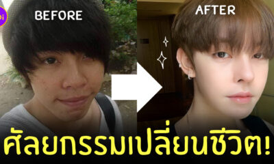 ผู้ชาย ศัลยกรรมเปลี่ยนชีวิต