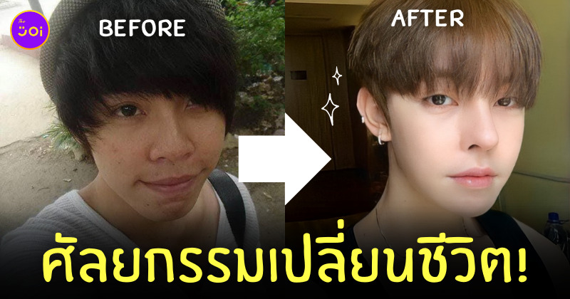ผู้ชาย ศัลยกรรมเปลี่ยนชีวิต