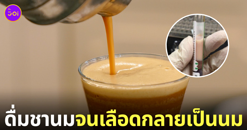 หนุ่มจีนดื่มชานมจนเลือดกลายเป็นนม