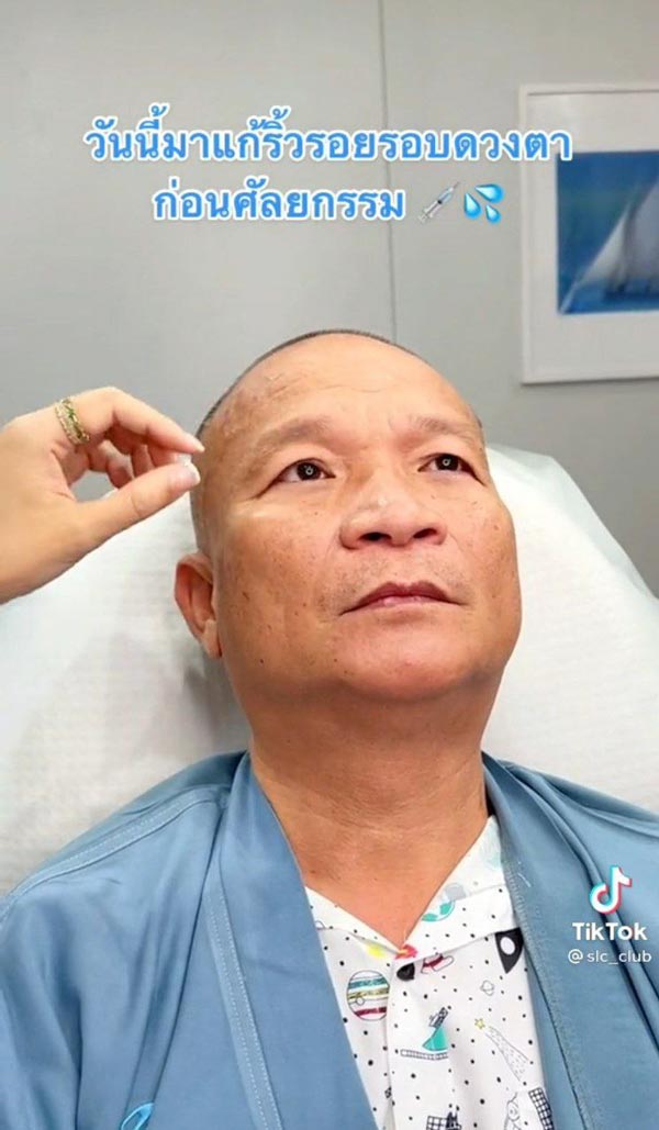 เผยหน้าใหม่ หม่ำ จ๊กมก หลังทำศัลยกรรมครั้งแรกในชีวิต