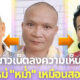 ชาวเน็ตแห่คอมเมนต์หน้าใหม่ หม่ำ จ๊กมก หลังศัลยฯ คล้าย พรศักดิ์ ส่องแสง-อุ๊บ วิริยะ