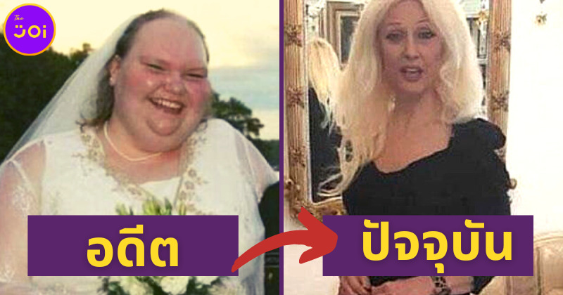 ยังจำ เอเลน่า เจ้าสาวที่น่าเกลียดที่สุดในโลกได้มั้ย ปัจจุบันสวยมากจนจำไม่ได้!