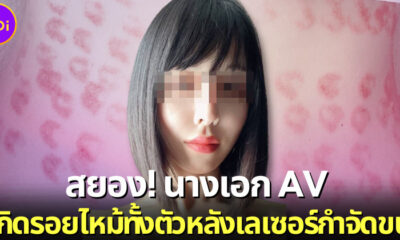 นางเอก AV ญี่ปุ่น ริริ โฮโช (Riri Hosho) มีรอยแผลไหม้ทั้งตัว เพราะเครื่องมือเลเซอร์กำจัดขนใหม่เกินไป!