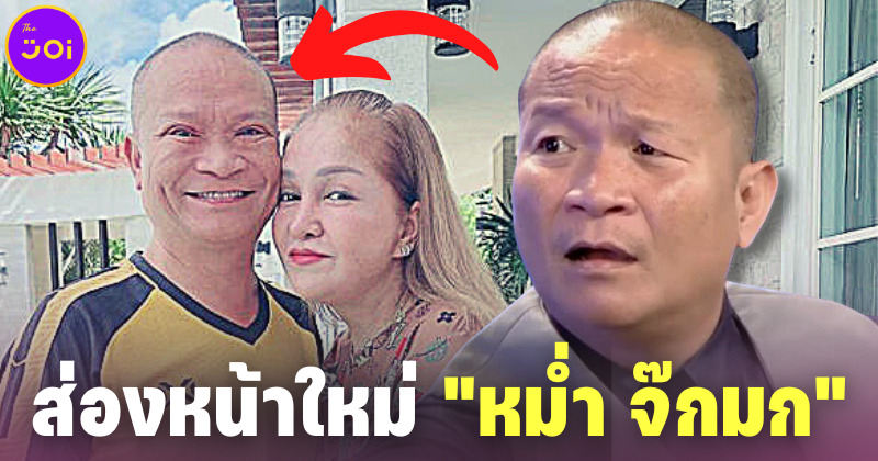 เผยหน้าใหม่ หม่ำ จ๊กมก หลังทำศัลยกรรมครั้งแรกในชีวิต