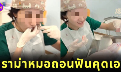 คลิปหมอฟันถอนฟันคุดเอง