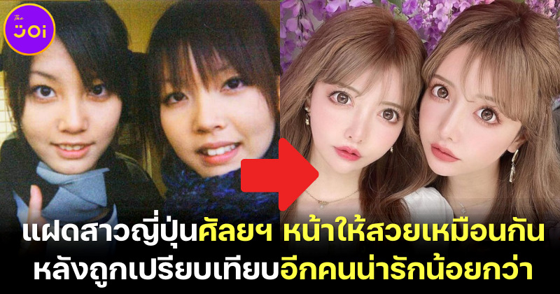 ฝาแฝดสาวชาวญี่ปุ่นลงทุน 10 ล้านบาท ศัลยกรรมใบหน้าให้สวยเหมือนกัน จบปัญหาถูกเปรียบเทียบอีกคนน่ารักน้อยกว่า