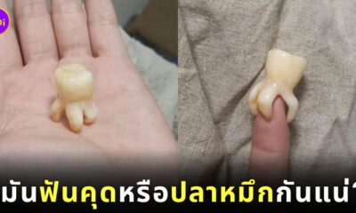 ฟันคุดเหมือนปลาหมึก