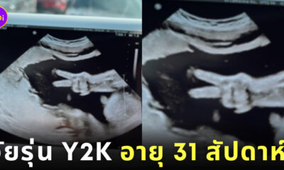 ภาพอัลตราซาวด์ ทารก ชู 2 นิ้ว