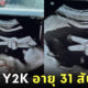 ภาพอัลตราซาวด์ ทารก ชู 2 นิ้ว
