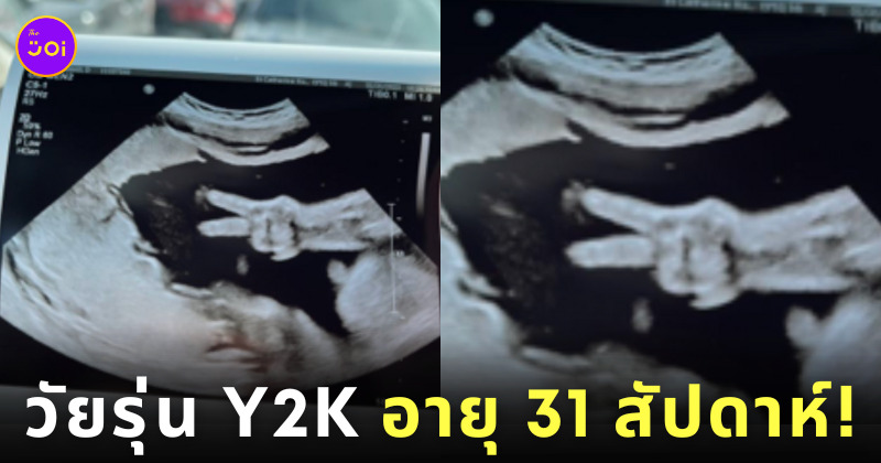 ภาพอัลตราซาวด์ ทารก ชู 2 นิ้ว