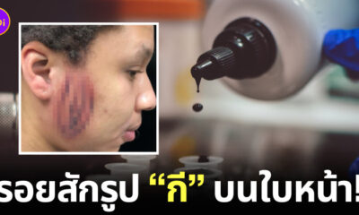 สักลาย รูปกี อวัยวะเพศหญิง บนหน้า