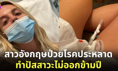 สาวอังกฤษป่วยโรคประหลาดทำปัสสาวะไม่ออกนานข้ามปี