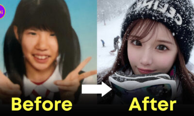 ฮิราเสะ ไอริ เนียอิริน ศัลยกรรม