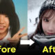 ฮิราเสะ ไอริ เนียอิริน ศัลยกรรม