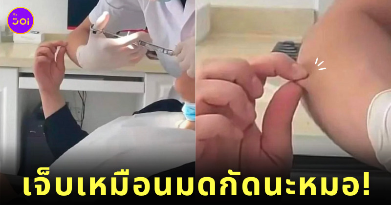 คนกลัวเข็ม หยิกแขนหมอ