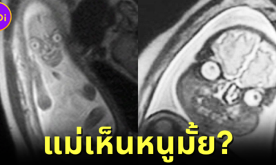 ปก ชาวเน็ตแห่แชร์ภาพคุณแม่ตรวจดูทารกในครรภ์ด้วย MRI ที่เห็นแล้วชวนขนหัวลุก
