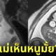 ปก ชาวเน็ตแห่แชร์ภาพคุณแม่ตรวจดูทารกในครรภ์ด้วย MRI ที่เห็นแล้วชวนขนหัวลุก