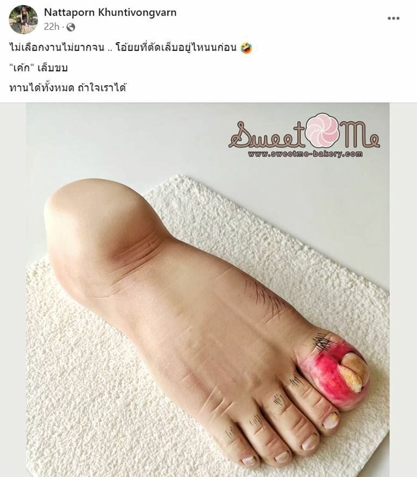 เค้กวันเกิดเล็บขบ