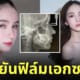 โยชิ รินรดา สวยยันฟิล์มเอกซเรย์ x-ray
