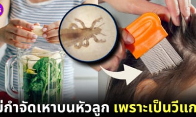 ปก คุณแม่ชาวออสเตรเลียไม่ยอมกำจัดเหาบนหัวลูกสาว เพราะเป็นวีแกน