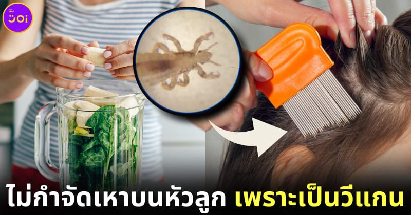 ปก คุณแม่ชาวออสเตรเลียไม่ยอมกำจัดเหาบนหัวลูกสาว เพราะเป็นวีแกน