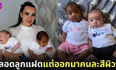 ปก คุณแม่อังกฤษคลอดลูกแฝดแต่ออกมาคนละสีผิว