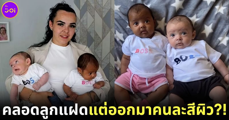 ปก คุณแม่อังกฤษคลอดลูกแฝดแต่ออกมาคนละสีผิว