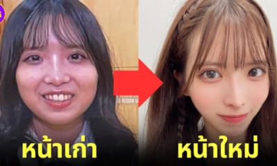 ปก ไอดอลสาวชาวญี่ปุ่นศัลยกรรมหน้าใหม่สวยกว่าเดิม