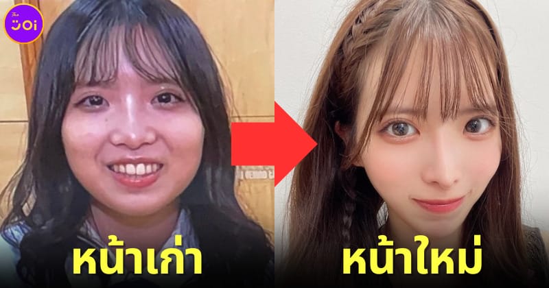 ปก ไอดอลสาวชาวญี่ปุ่นศัลยกรรมหน้าใหม่สวยกว่าเดิม