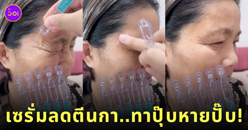 คลิปรีวิวเซรั่มลดริ้วรอยตีนกา ทาปุ๊บรอยหายปั๊บ TikTok