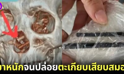 หนุ่มเวียดนาม ตะเกียบ เสียบสมอง
