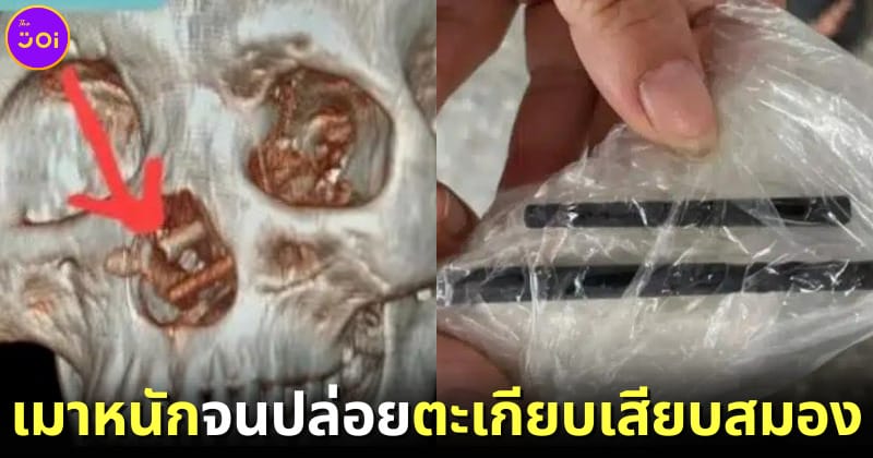 หนุ่มเวียดนาม ตะเกียบ เสียบสมอง