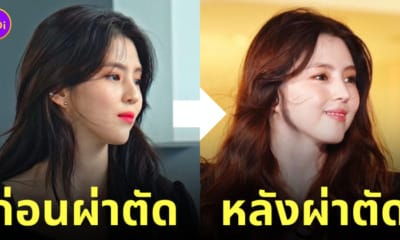 ฮันโซฮี ทำจมูกใหม่