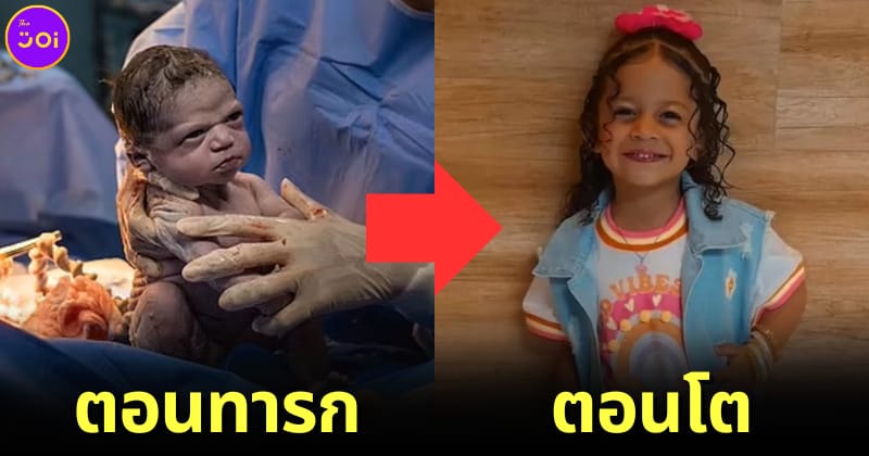 เด็กในมีมทารกหน้าบึ้งโตแล้ว