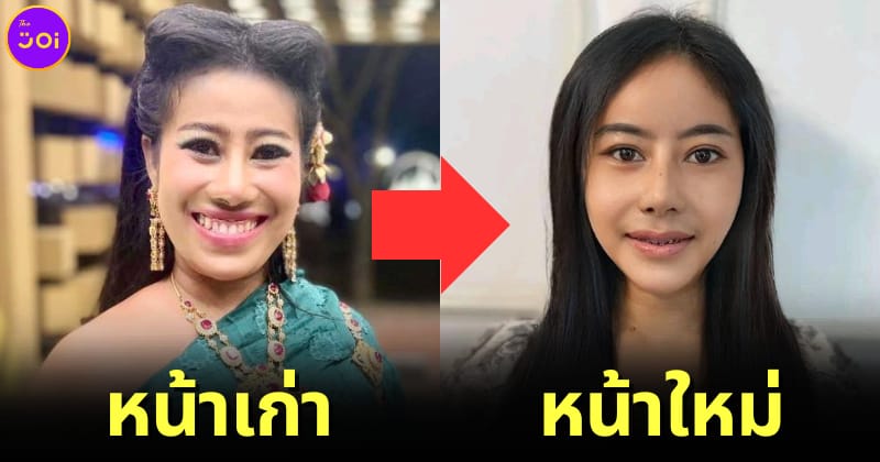ปก หนูรัตน์เฮเลน เผยหน้าใหม่หลังศัลยกรรม