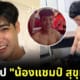 เปิดวาร์ป น้องแชมป์ สุขุมวิท 11