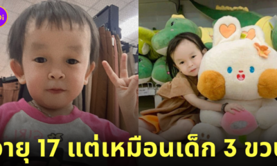 สาวป่วยโรคหายาก เหมือนเด็ก 3 ขวบ
