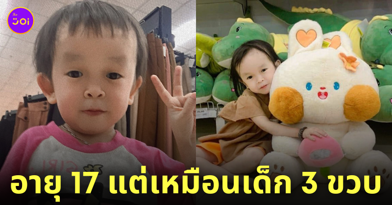 สาวป่วยโรคหายาก เหมือนเด็ก 3 ขวบ