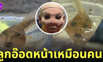 ลูกอ๊อดหน้าเหมือนคนเอาถุงน่องครอบหัว