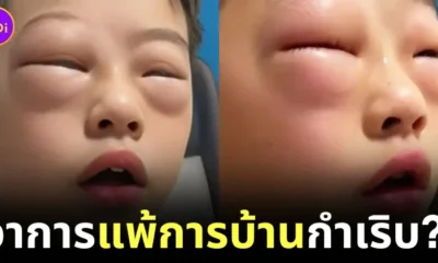 คุณแม่เป็นห่วงหนูน้อยชาวจีนเป็น "โรคแพ้การบ้าน" เริ่มทำทีไร ตาบวมตุ่ยทุกที!